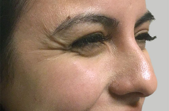 woman's eyes with wrinkles