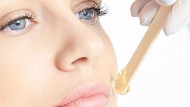 Woman with blue eyes receiving skin treatment.