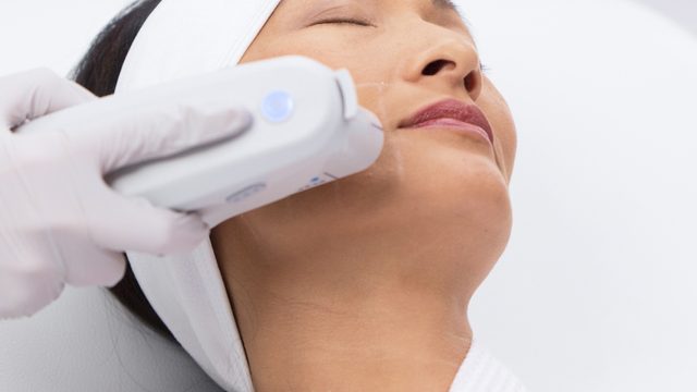 Woman with white headband laying down with her eyes closed receiving Ultherapy on her face.