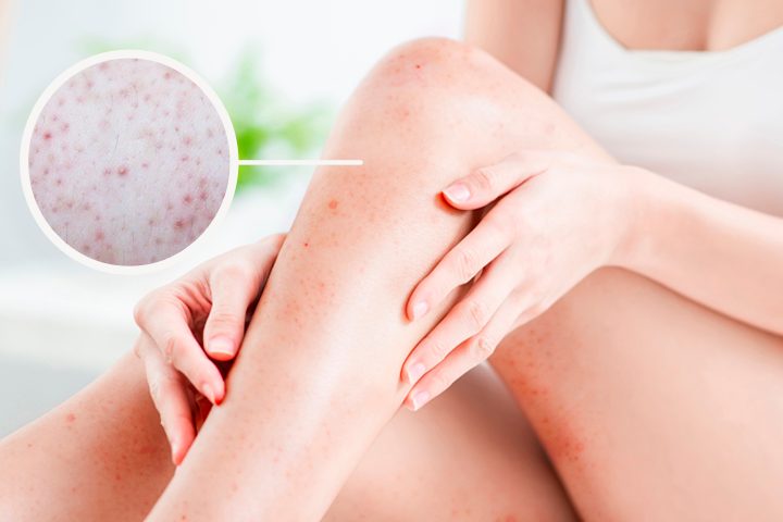 Patient, Person, Skin