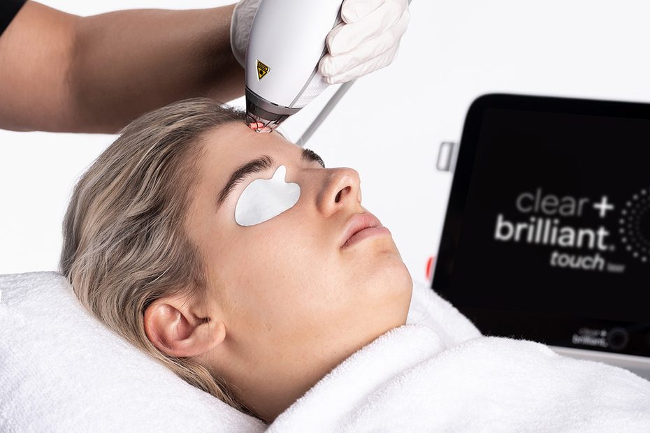 Woman laying with a towel over here with a white eye covering while receiving Clear & Brilliant on her forehead region.