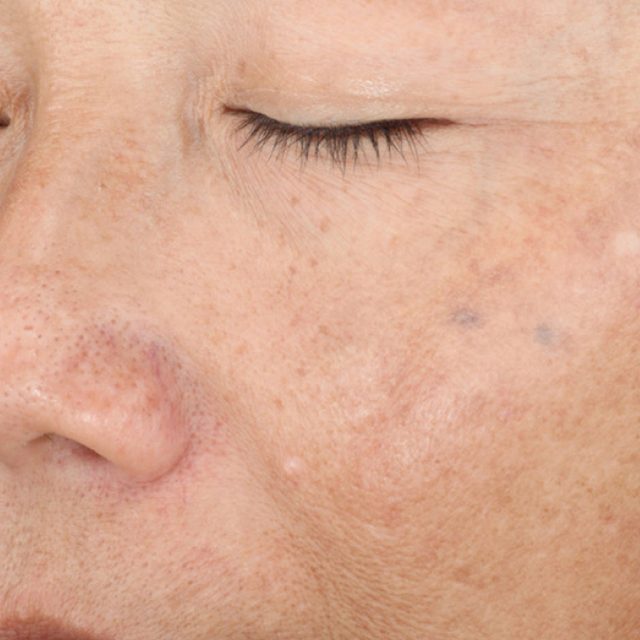 Closeup of left side of a woman's face region.