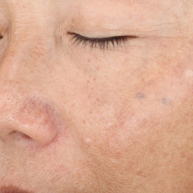 Closeup of left side of a woman's face region.