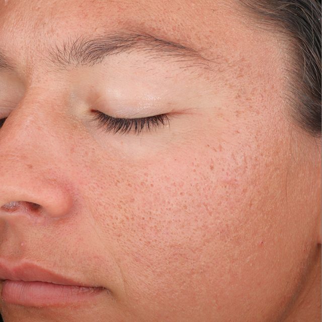 Closeup of left side of a woman's face region.