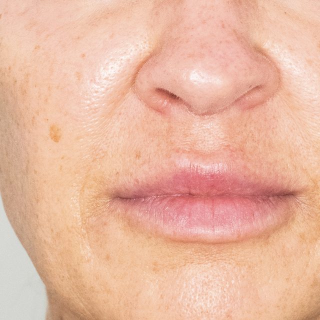 Closeup of a person's nose and lip area.