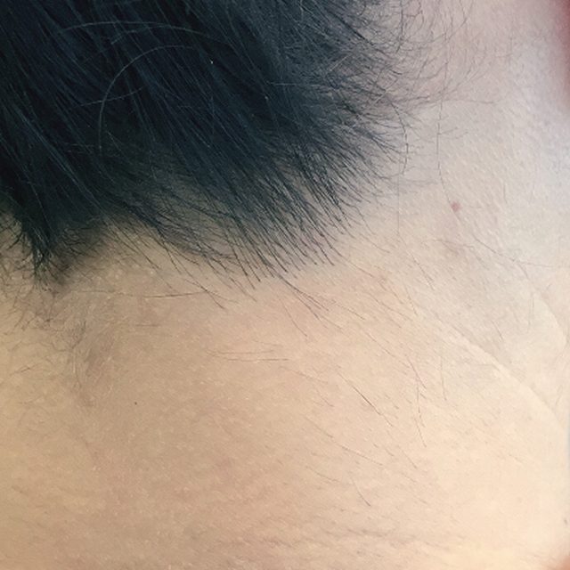 Closeup of someone with black hair in the head and neck region.