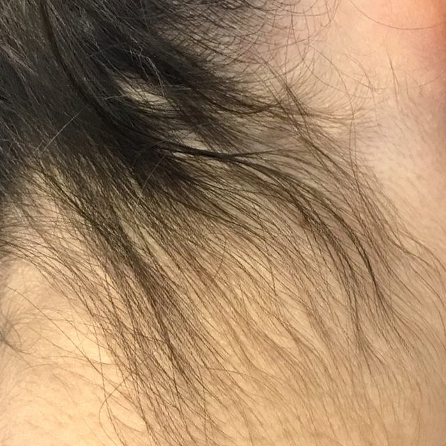 Closeup of someone with long black hair in the head and neck region.