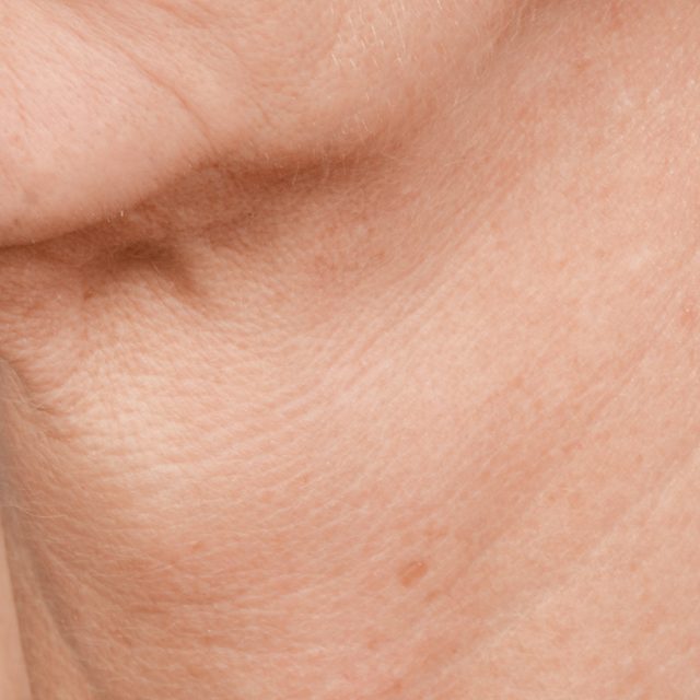Closeup of a person's neck region.