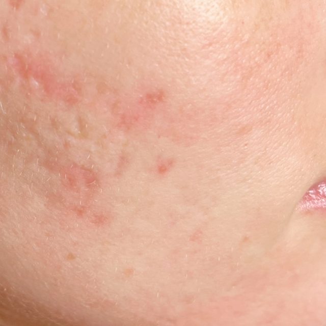 Closeup of a person's face area.