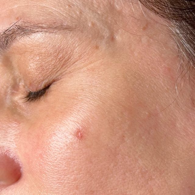 Closeup of a woman's face.