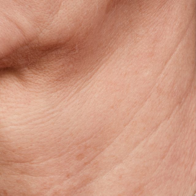 Closeup of a person's neck region.