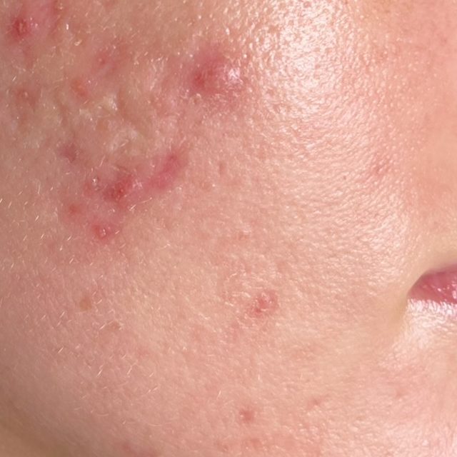 Closeup of a person's face area.