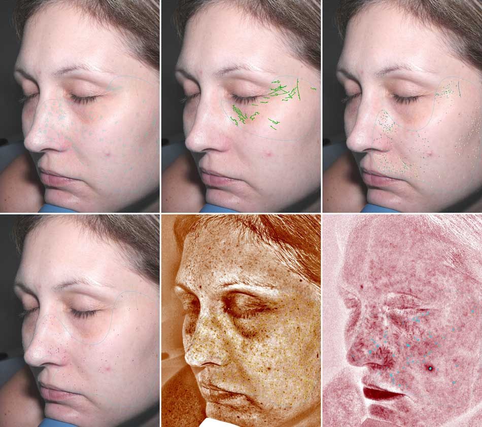 Reveal results Reveal results