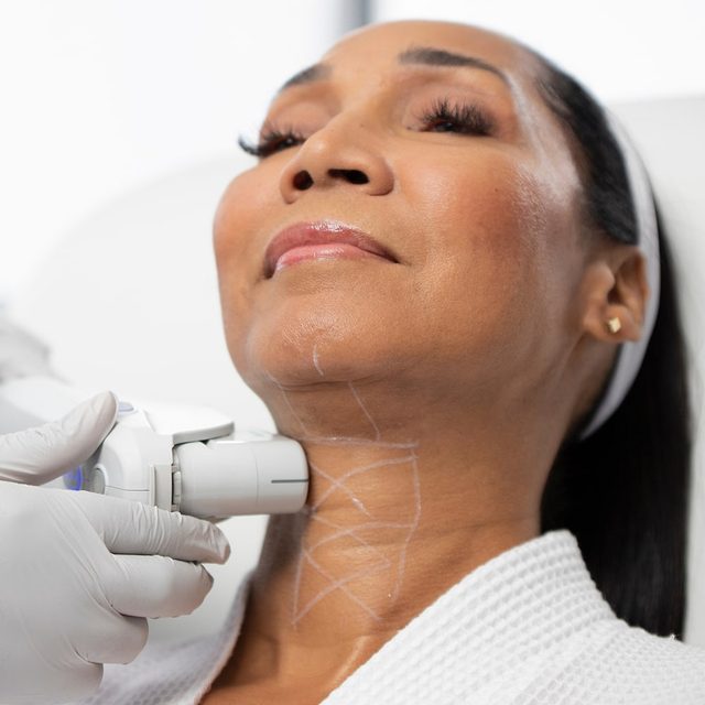 Woman wearing white clothing receiving Ultherapy service on her neck region.