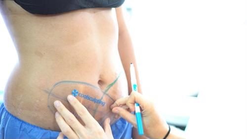 Back, Body Part, Person