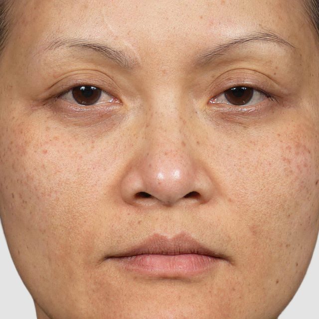Closeup of a woman's face.