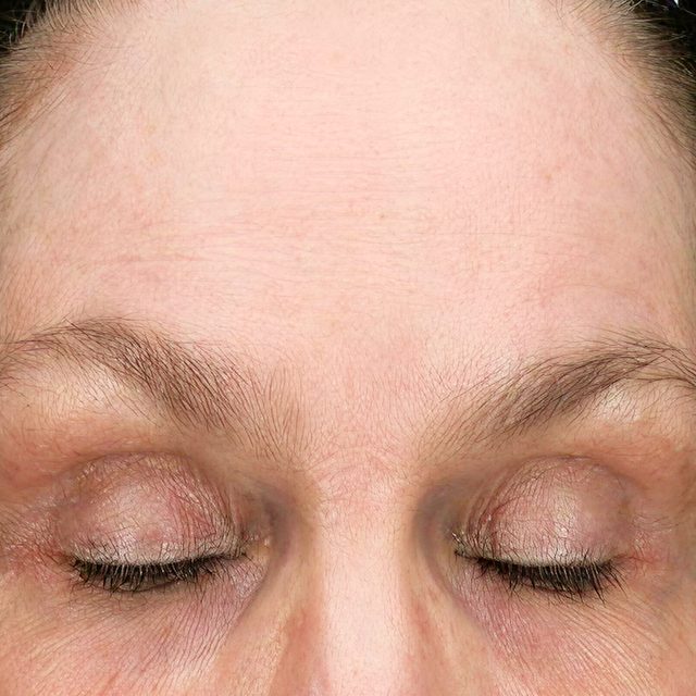 Closeup of a woman's forehead region with her eyes closed.
