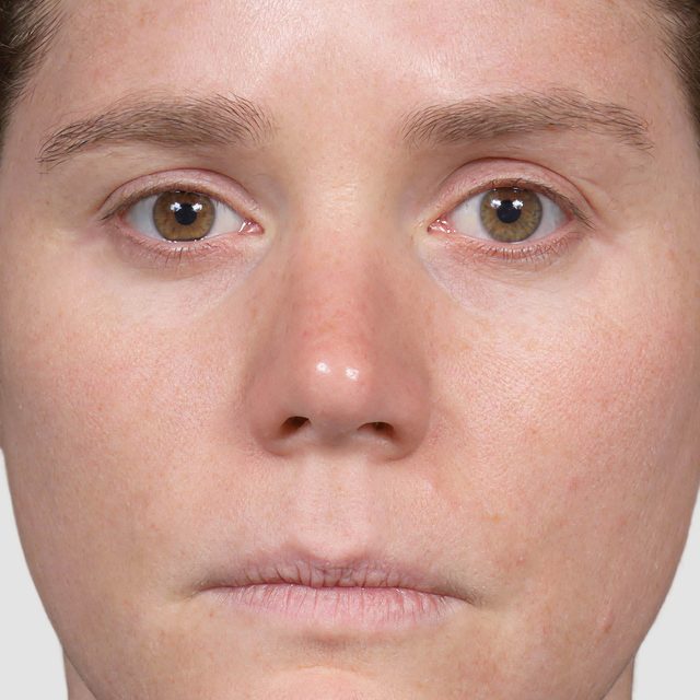 Closeup of a woman's face with her eyes open.