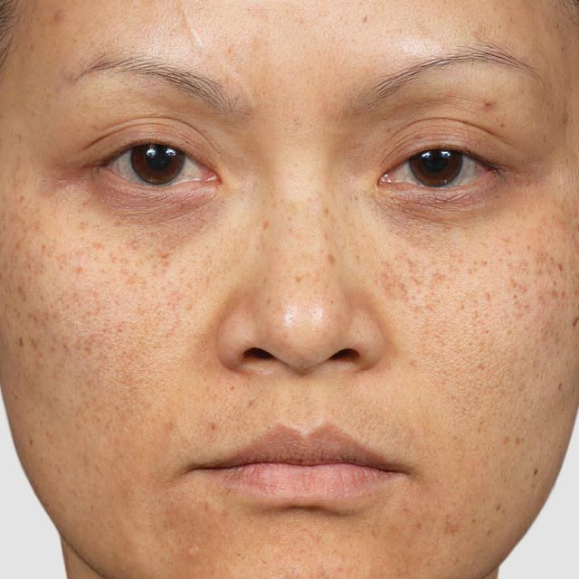 Closeup of a woman's face.