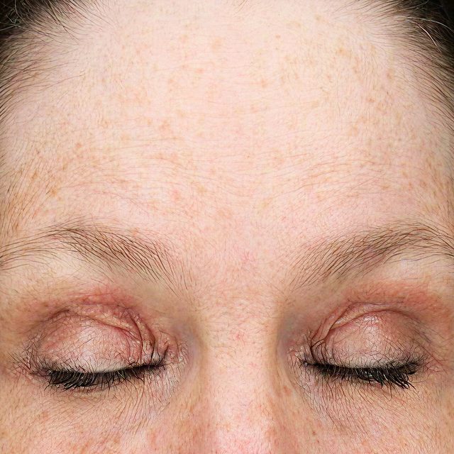 Closeup of a woman's forehead while her eyes are closed.