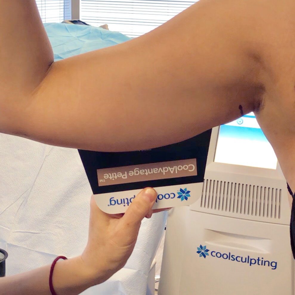 Arm, Body Part, Person