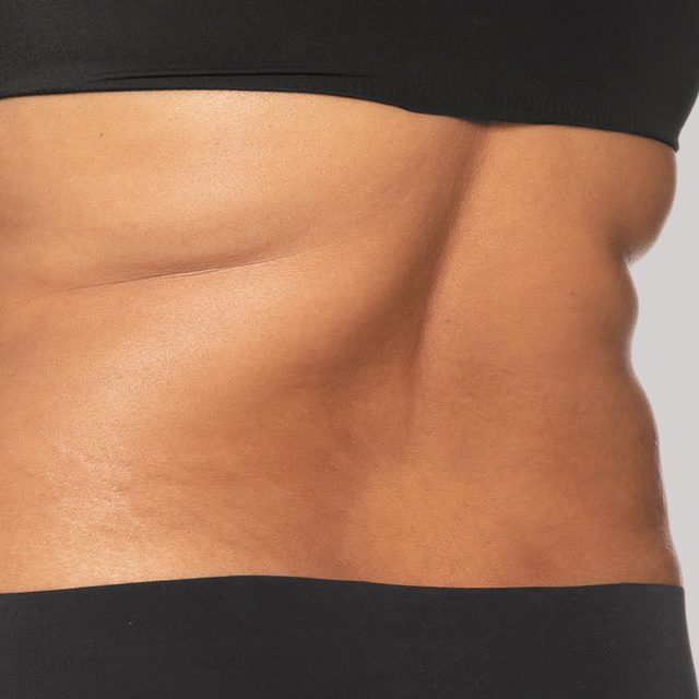 Closeup of a person's back.