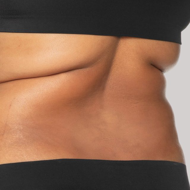 Closeup of a person's back region.