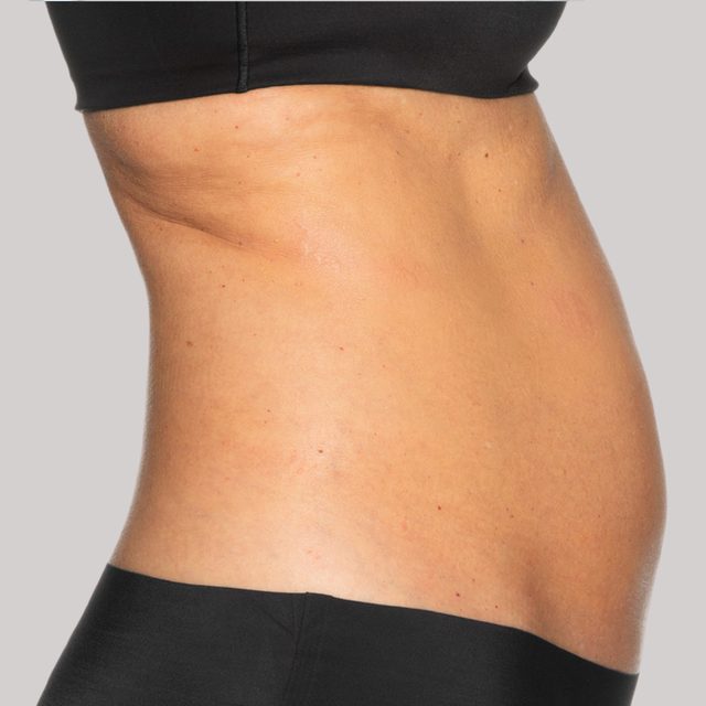 Side angle of a woman's back and stomach region while wearing black undergarments.