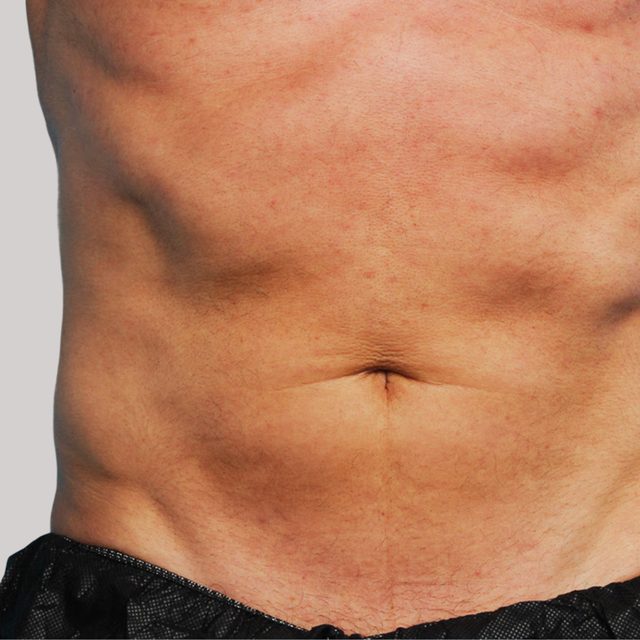 Closeup of a male's stomach and abdomen area.