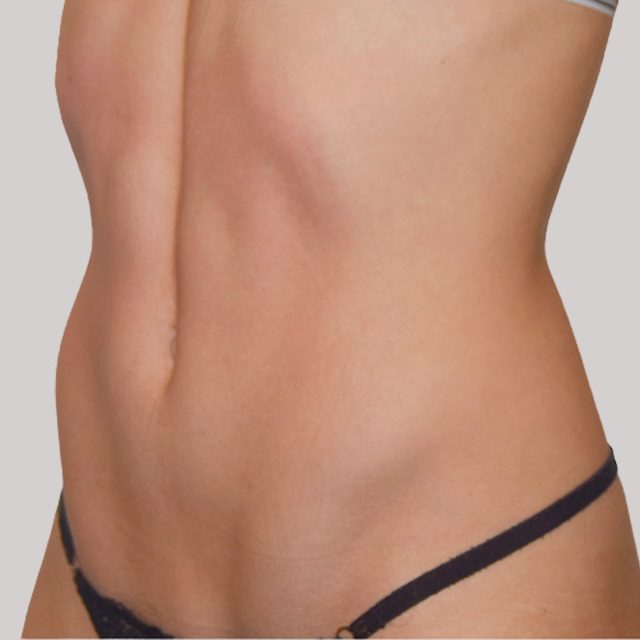 Closeup of a woman's stomach and abdomen region.