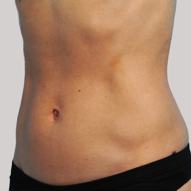 Closeup of the stomach region of a person.
