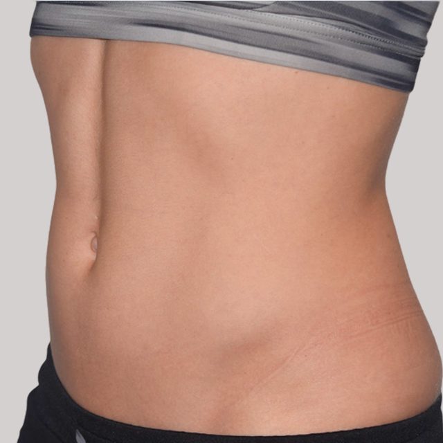 Closeup of a woman's stomach and abdomen region.