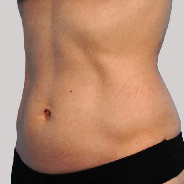 Closeup of the stomach region of a person.