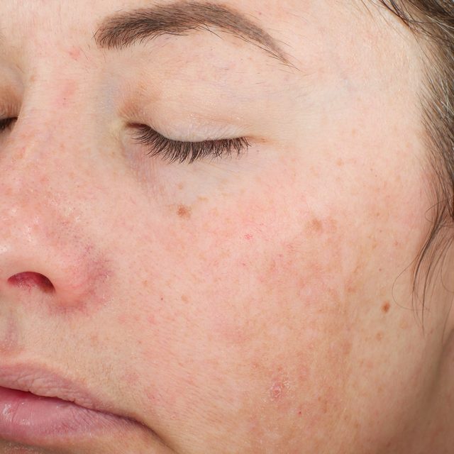 Closeup of a woman's face.