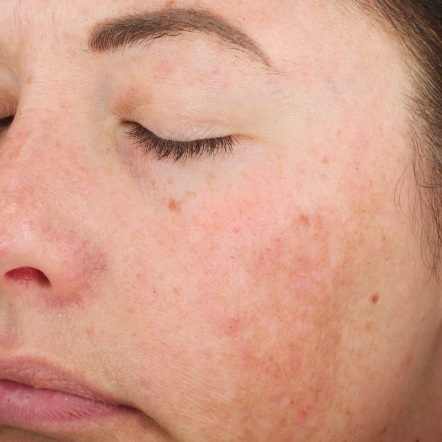 Closeup of a woman's face while her eyes are closed.
