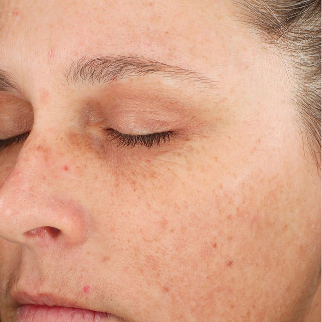 Closeup of a woman's face while her eyes are closed.