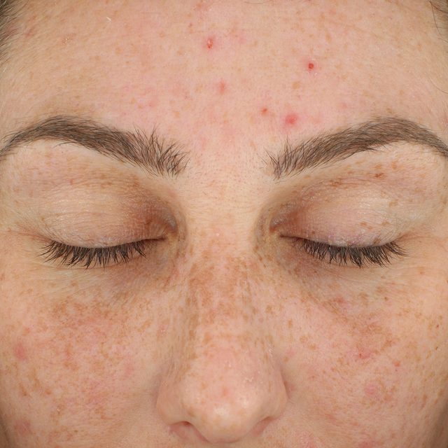 Closeup of a woman's face while her eyes are closed.