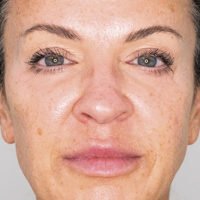 Closeup of a woman's face with her eyes open.