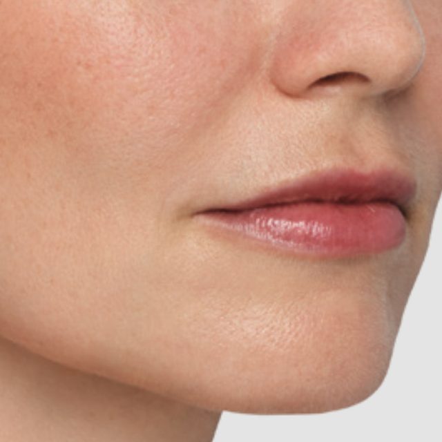 Closeup of a side angle of a woman's nose and lip area.