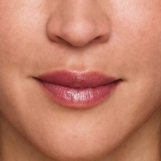 Closeup of a woman's nose and lip area.