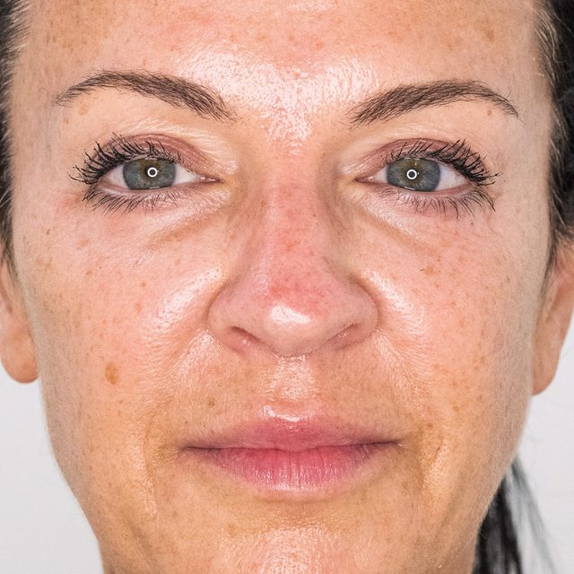 Closeup of a woman's face area with her eyes open.