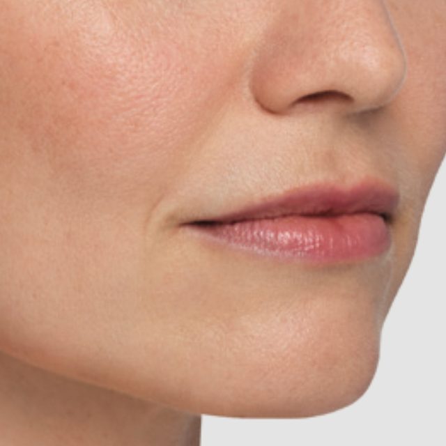 Closeup of a side angle of a woman's nose and lip area.