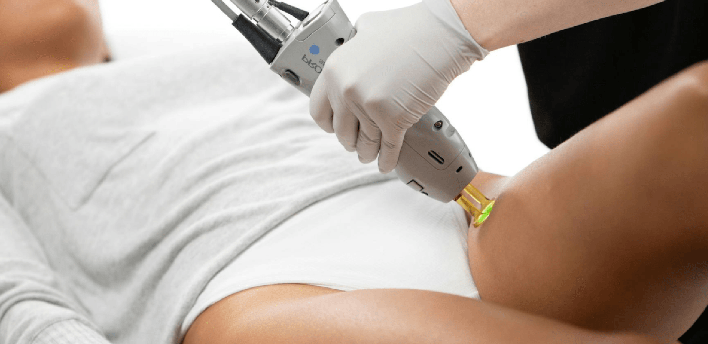 Person with white clothing receiving laser hair removal treatment on upper thigh.