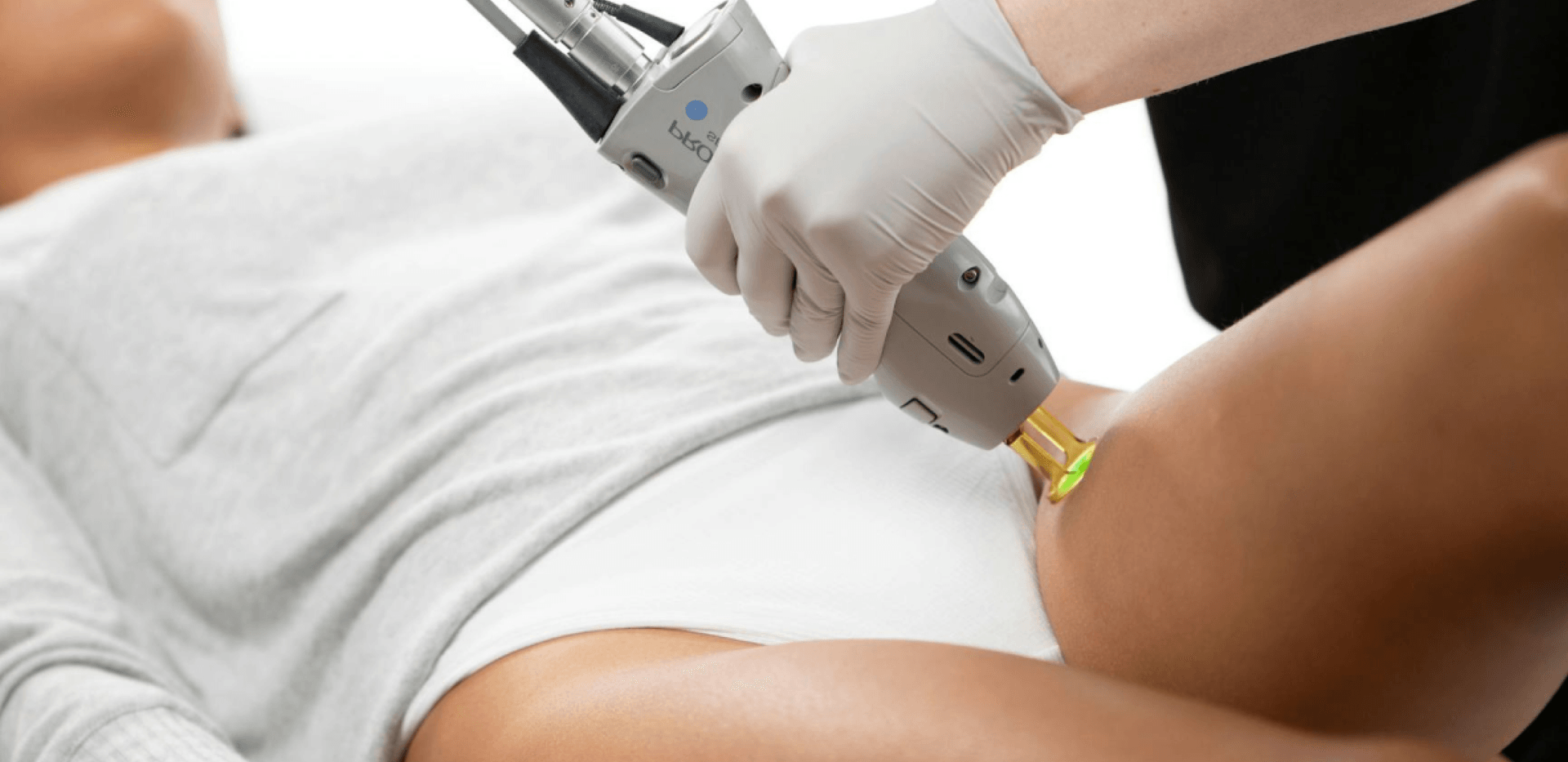 Person with white clothing receiving laser hair removal treatment on upper thigh.