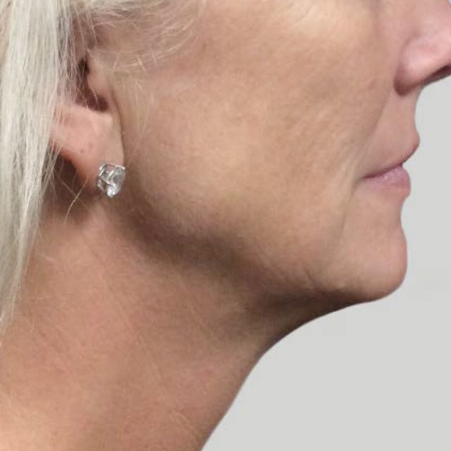 Side angle of a woman's neck area while an earring in her right ear.