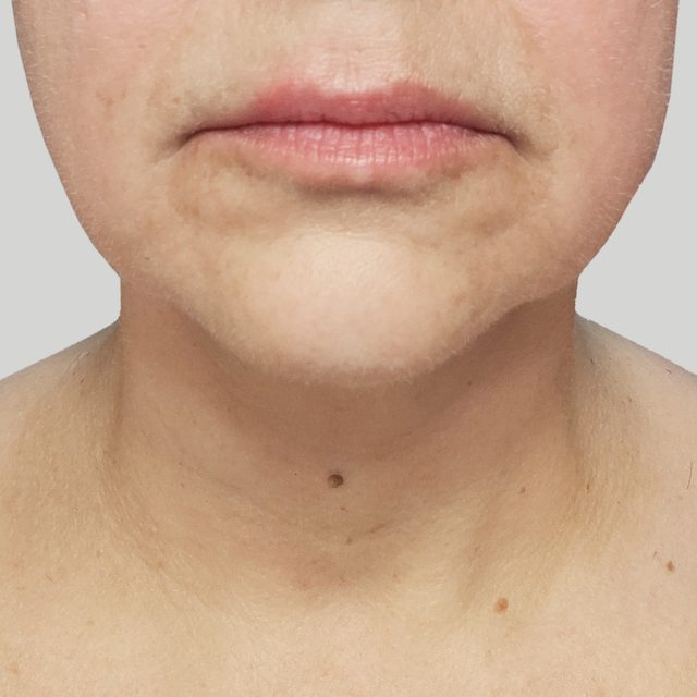 Closeup of a person's neck and lip area.