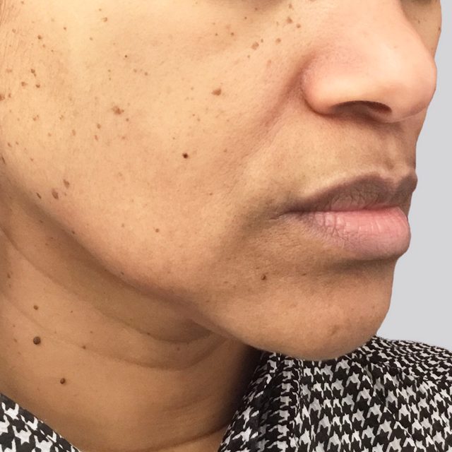 Side angle of a person's cheek, nose, and lip region.
