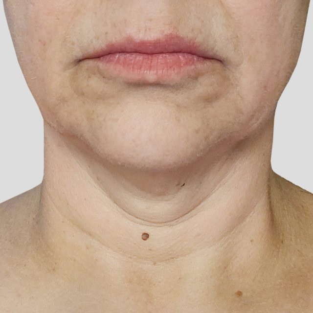 Closeup of a person's neck and lip area.