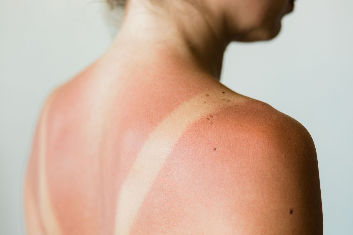 Body Part, Person, Shoulder