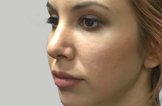 woman's face before treatment